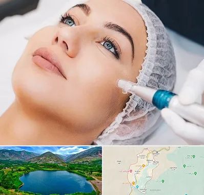 مزونیدلینگ در رودبار