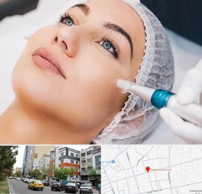 مزونیدلینگ در هفده شهریور تبریز