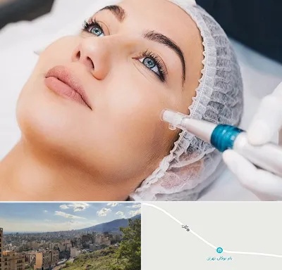 مزونیدلینگ در بوکان تهران