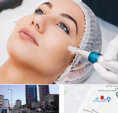 مزونیدلینگ در چهارراه طالقانی کرج