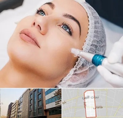 مزونیدلینگ در نجات اللهی