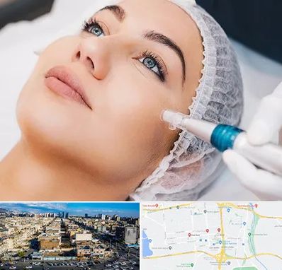 مزونیدلینگ در شهرک راه آهن