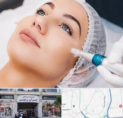 مزونیدلینگ در ایران زمین