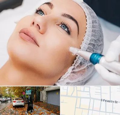 مزونیدلینگ در خیابان فلسطین