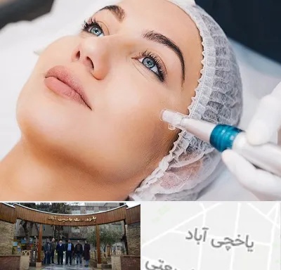 مزونیدلینگ در یاخچی آباد