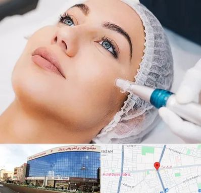 مزونیدلینگ در نصف راه تبریز