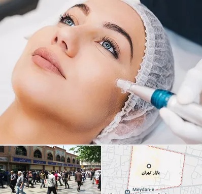 مزونیدلینگ در بازار تهران