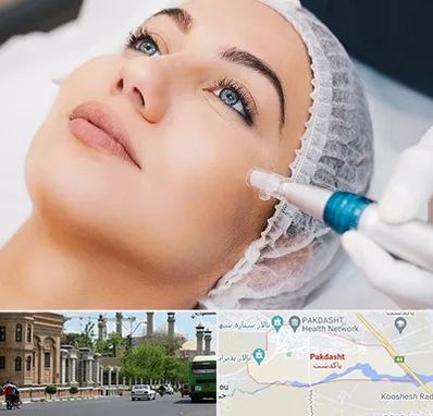 مزونیدلینگ در پاکدشت