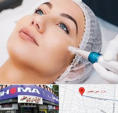 مزونیدلینگ در امین حضور