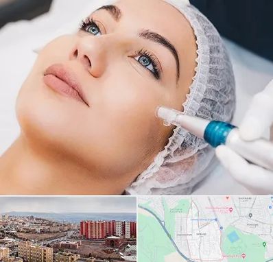 مزونیدلینگ در سهند تبریز