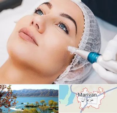مزونیدلینگ در مریوان