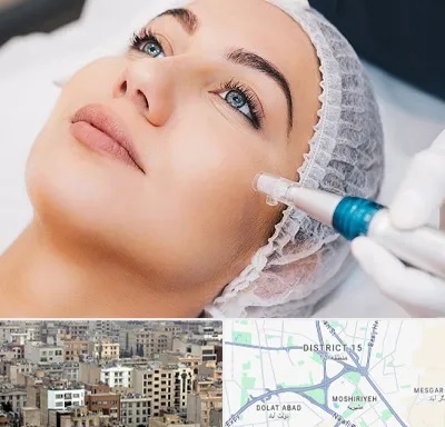 مزونیدلینگ در جنوب شرق تهران