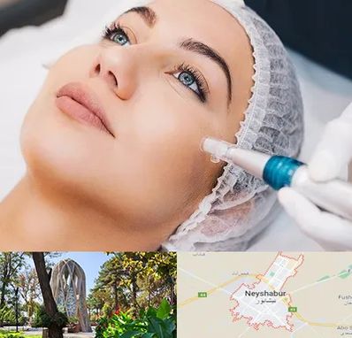 مزونیدلینگ در نیشابور