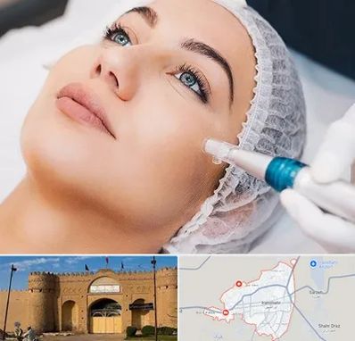 مزونیدلینگ در ایرانشهر