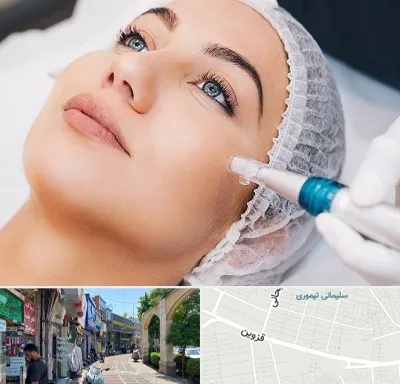 مزونیدلینگ در خیابان قزوین
