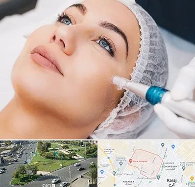 مزونیدلینگ در شاهین ویلا کرج