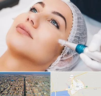 مزونیدلینگ در بندر ماهشهر