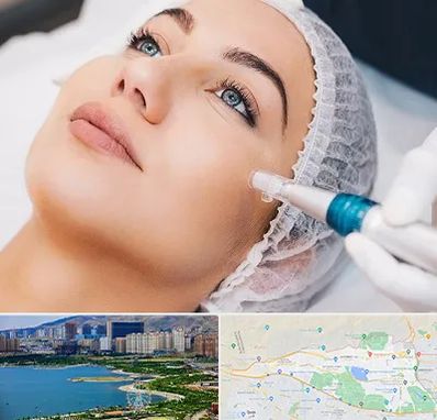 مزونیدلینگ در منطقه 22 تهران 