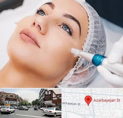 مزونیدلینگ در خیابان آذربایجان