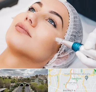 مزونیدلینگ در یوسف آباد 