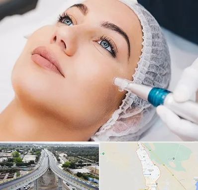 مزونیدلینگ در اندیمشک