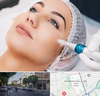 مزونیدلینگ در شهرک ولیعصر