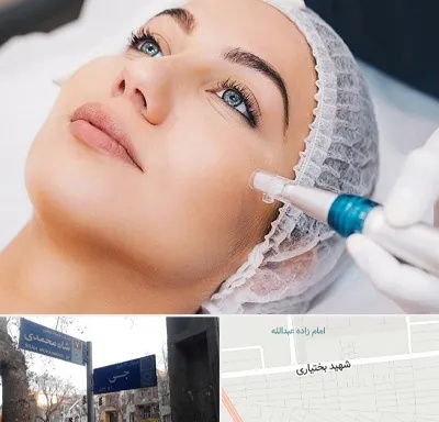 مزونیدلینگ در سی متری جی