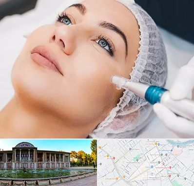 مزونیدلینگ در عفیف آباد شیراز