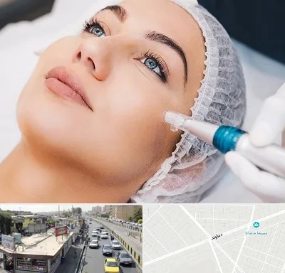 مزونیدلینگ در خیابان دماوند