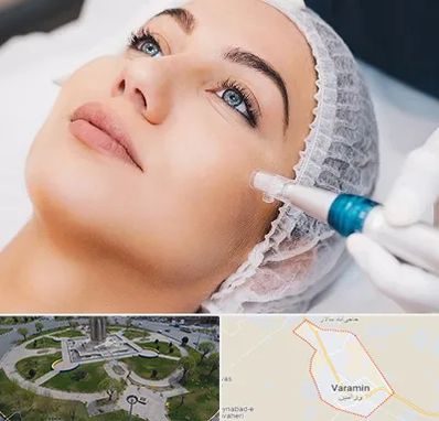 مزونیدلینگ در ورامین