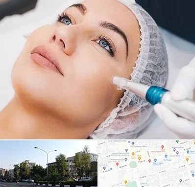 مزونیدلینگ در میدان کاج 