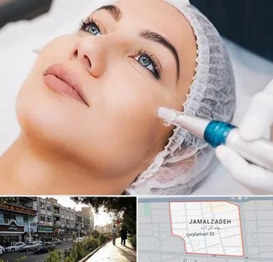 مزونیدلینگ در خیابان جمالزاده