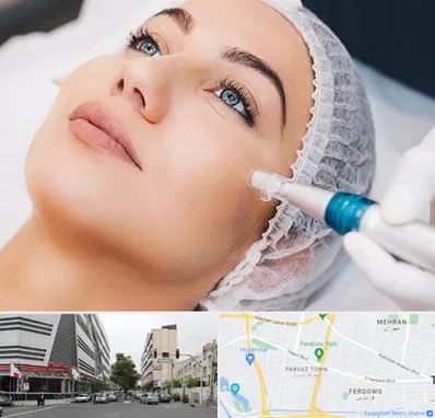 مزونیدلینگ در بلوار فردوس 