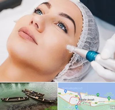 مزونیدلینگ در بندر انزلی