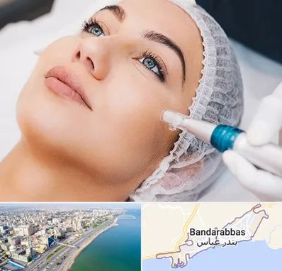 مزونیدلینگ در بندرعباس