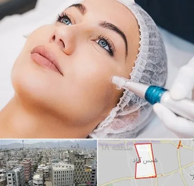 مزونیدلینگ در شمس آباد تهران