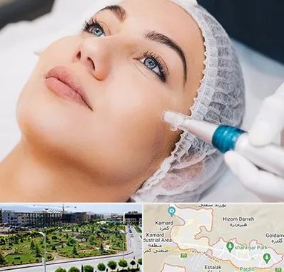 مزونیدلینگ در پردیس