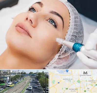 مزونیدلینگ در جنوب تهران 