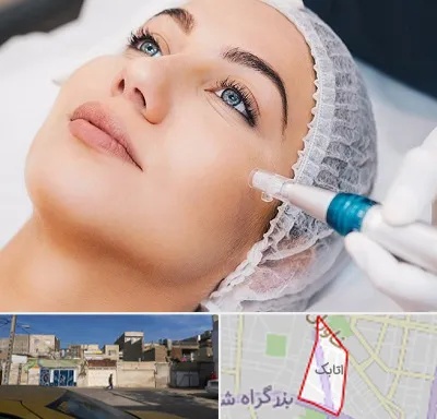مزونیدلینگ در اتابک