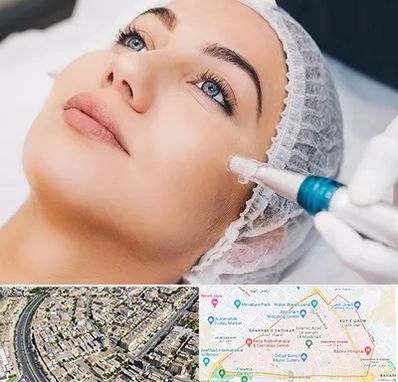 مزونیدلینگ در شهرک غرب مشهد