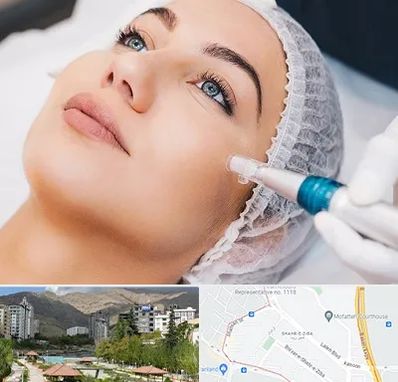 مزونیدلینگ در شهر زیبا 