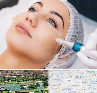 مزونیدلینگ در منطقه 9 تهران 