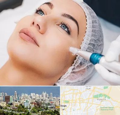 مزونیدلینگ در شرق تهران 