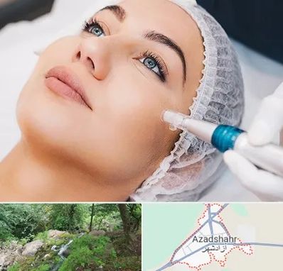 مزونیدلینگ در آزادشهر
