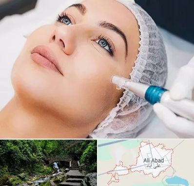مزونیدلینگ در علی‌ آباد کتول
