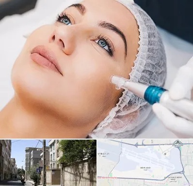 مزونیدلینگ در مهرآباد