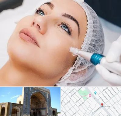 مزونیدلینگ در مصلی مشهد