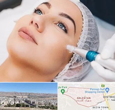 مزونیدلینگ در شهرک گلستان شیراز