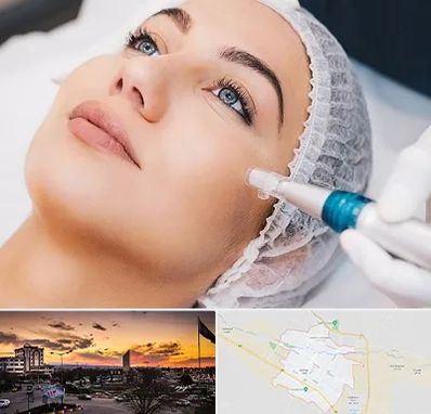 مزونیدلینگ در قوچان