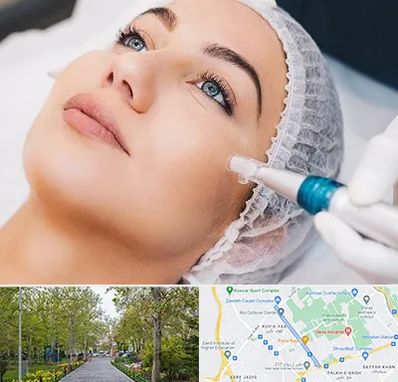 مزونیدلینگ در قدوسی غربی شیراز